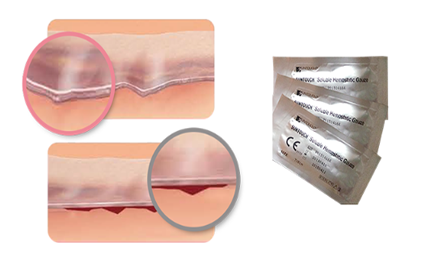 hemostatic-gauze-reef-cuts
