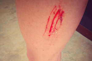 surf-first-aid-kit-review